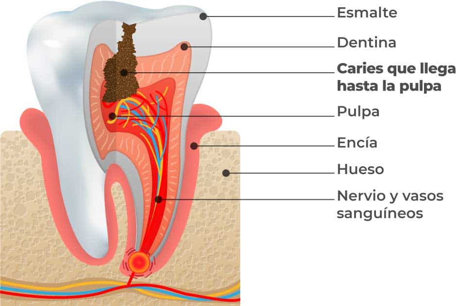 estructura-de-un-diente-endodoncia