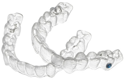 invisalign-teen-alineadores-invisibles-para-jovenes invisalign-teen-alineadores-invisibles-para-jovenes