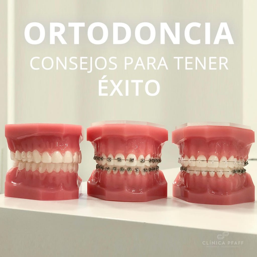 ortodoncia-consejos-para-tener-exito