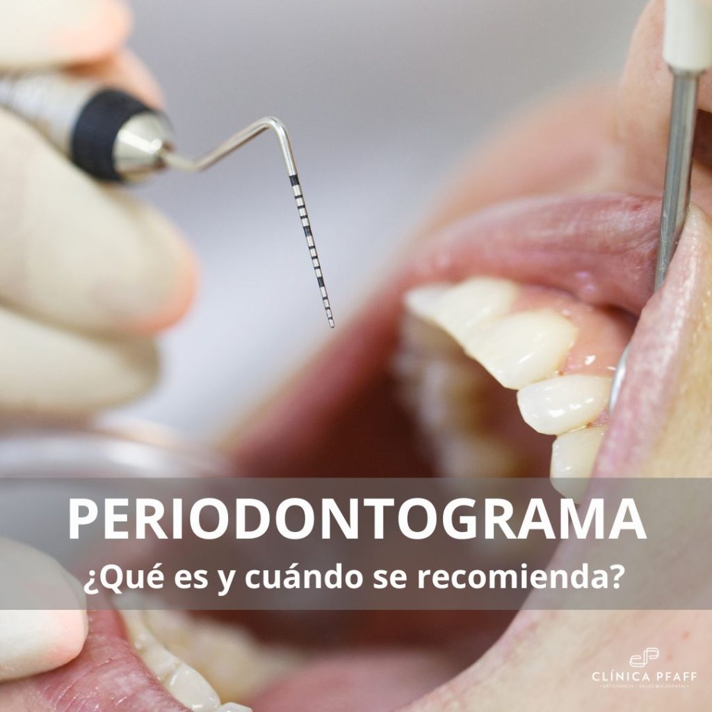 Instrumento dental utilizado para un periodontograma en Clínica Pfaff