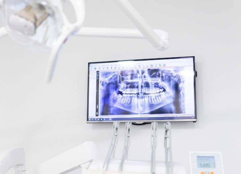 Tecnología digital tratamiento ortodoncia con brackets Pfaff