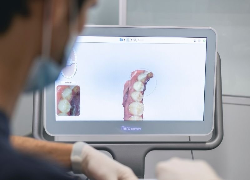 Tecnología digital en nuestros tratamientos de ortodoncia